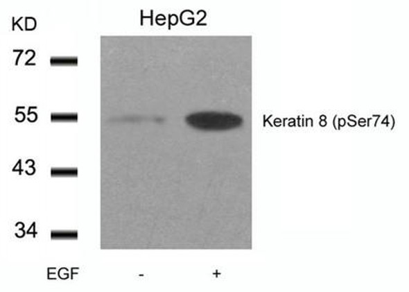 Phospho-KRT8 (Ser74) Antibody (PACO24500)