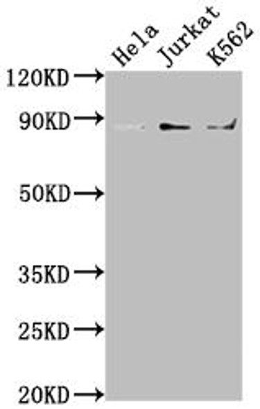 Anti-IKBKB Antibody (RACO0246)