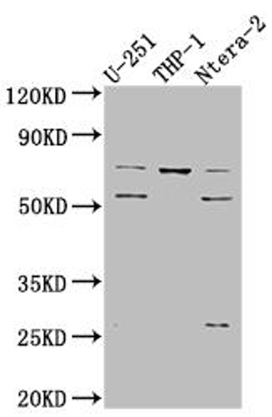 Anti-PTH1R Antibody (RACO0457)