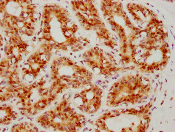 Anti-ATF4 Antibody (RACO0178)