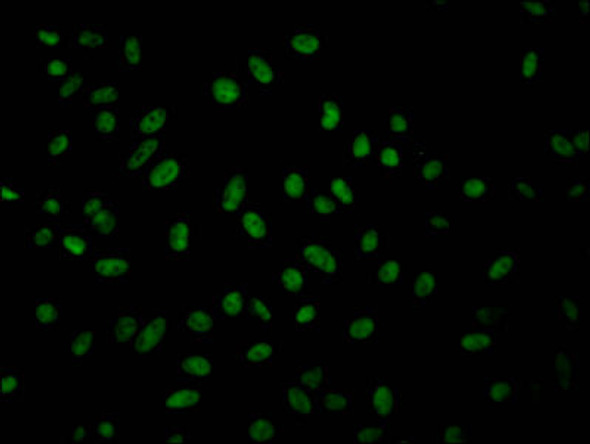 Anti-GMNN Antibody (RACO0434)