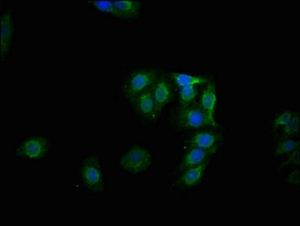 Anti-Phospho-GYS1 (S641) Antibody (RACO0054)