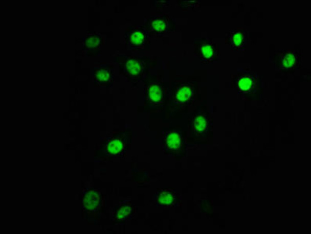 Anti-Phospho-ATF2 (T71) Antibody (RACO0077)