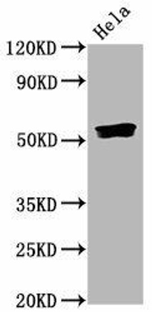 Anti-Phospho-SMAD5 (S463/S465) Antibody (RACO0096)