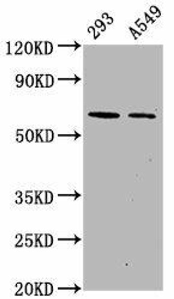 Anti-Phospho-PRKAA2 (S491) Antibody (RACO0116)