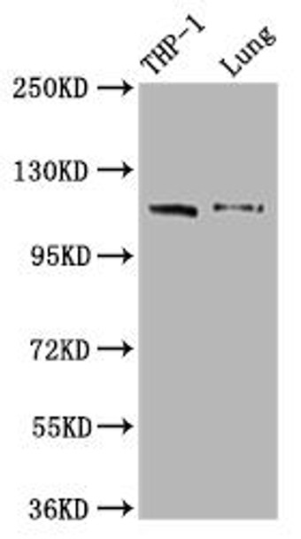 Anti-IFIH1 Antibody (RACO0390)