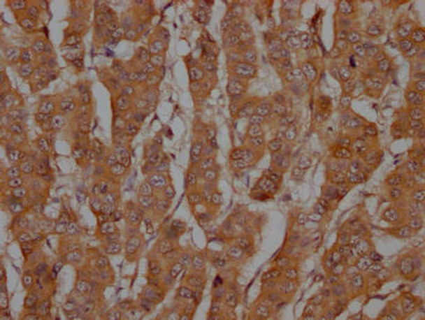 Anti-CASP3 Antibody (RACO0404)