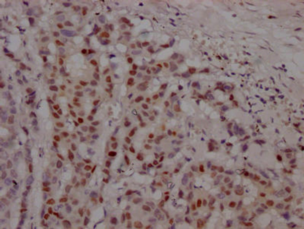 Anti-AR Antibody (RACO0409)