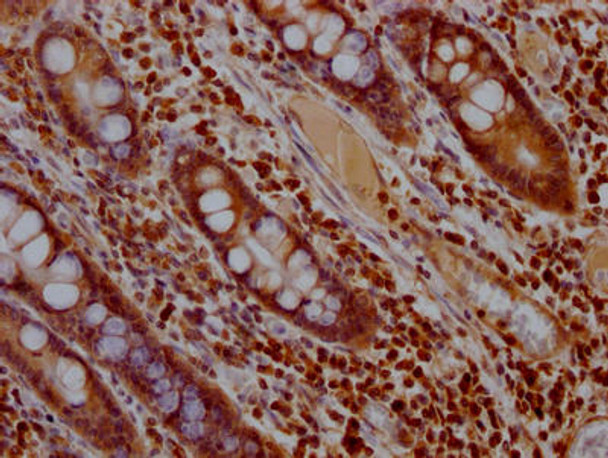 Anti-MAPK1 Antibody (RACO0445)