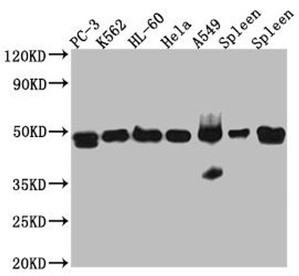 Anti-ACTR3 Antibody (RACO0503)