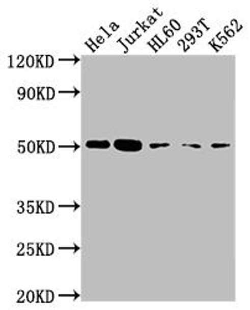 Anti-CASP2 Antibody (RACO0263)