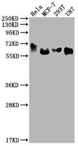 Anti-GBA Antibody (RACO0322)