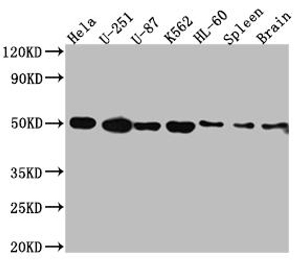 Anti-DRD3 Antibody (RACO0484)