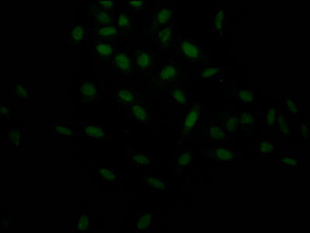 Anti-HIF1A Antibody (RACO0486)