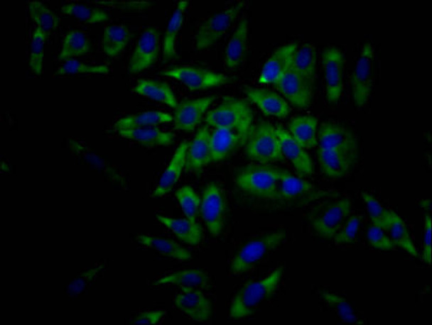 Anti-EIF4A1 Antibody (RACO0501)