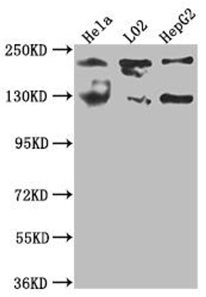 Anti-MGEA5 Antibody (RACO0510)