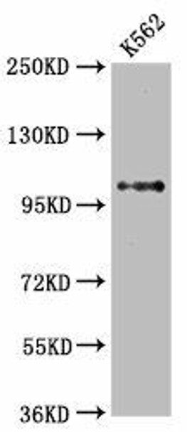 Anti-DGCR8 Antibody (RACO0145)