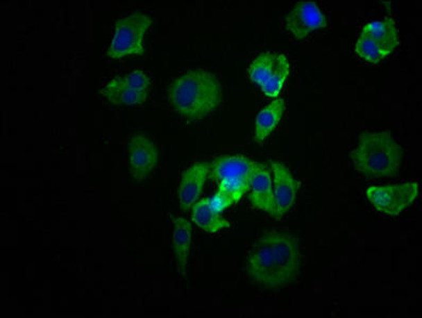 Anti-SRC Antibody (RACO0184)