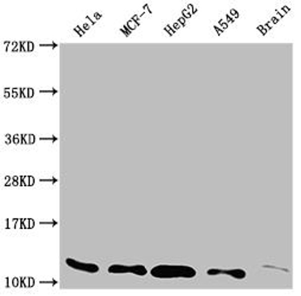 Anti-TXN Antibody (RACO0313)