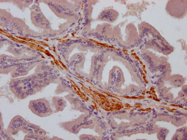 Anti-TRPM8 Antibody (RACO0385)