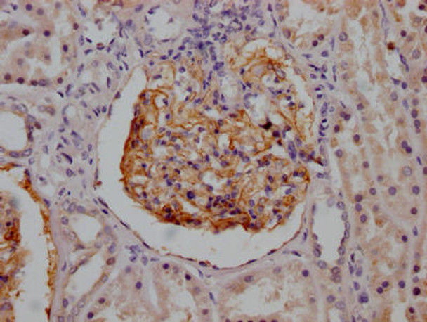 Anti-CR1 Antibody (RACO0435)