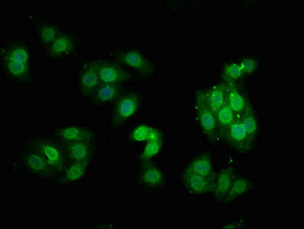 Anti-Phospho-PRKCA (T638) Antibody (RACO0111)