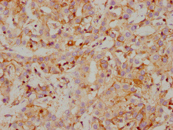 Anti-CA9 Antibody (RACO0149)