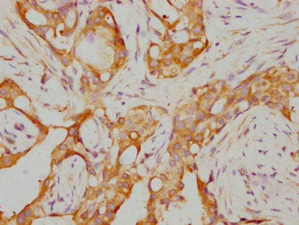 Anti-RARA Antibody (RACO0189)