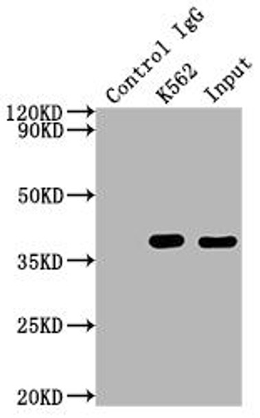Anti-CDK6 Antibody (RACO0273)