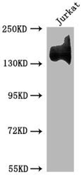 Anti-ITGA4 Antibody (RACO0298)