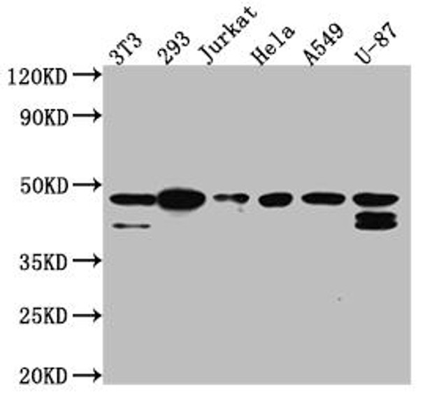 Anti-CSNK2A1 Antibody (RACO0540)