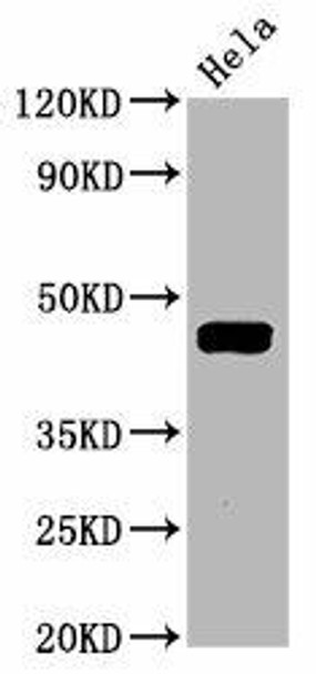 Anti-Phospho-MAP2K1 (T292) Antibody (RACO0098)
