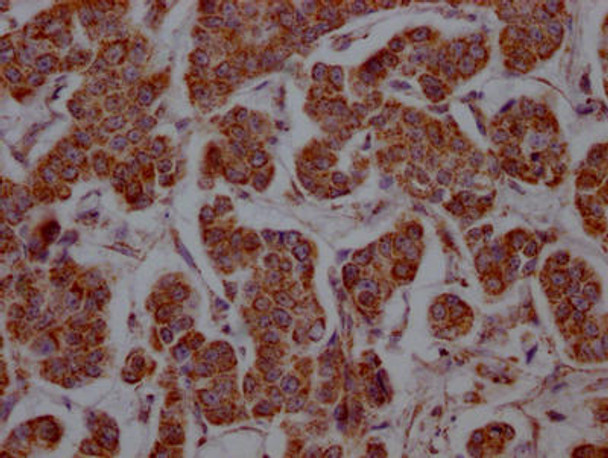 Anti-SLC16A1 Antibody (RACO0438)