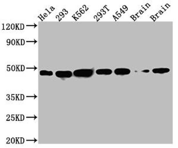 Anti-NUDC Antibody (RACO0573)