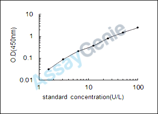 Human Retinal dehydrogenase 1 (ALDH1A1) ELISA Kit (HUEB0797)