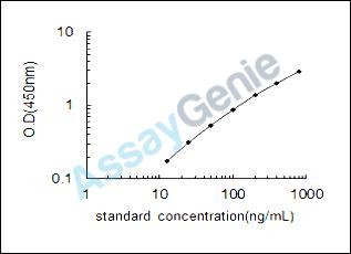 Human Microalbuminuria (MAU) ELISA Kit (HUEB1555)