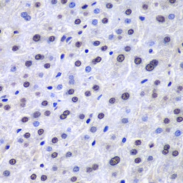 Anti-APEX1 Antibody (CAB1117)