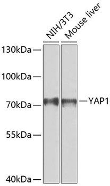 Anti-YAP1 Antibody (CAB11430)