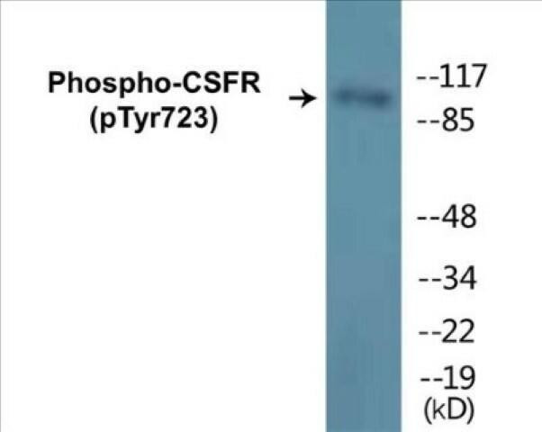 CSFR (Phospho-Tyr723)Colorimetric Cell-Based ELISA Kit (CBCAB00018)