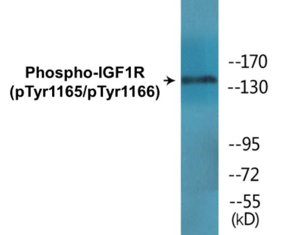 IGF1R (Phospho-Tyr1165/Tyr1166)Colorimetric Cell-Based ELISA Kit (CBCAB00028)