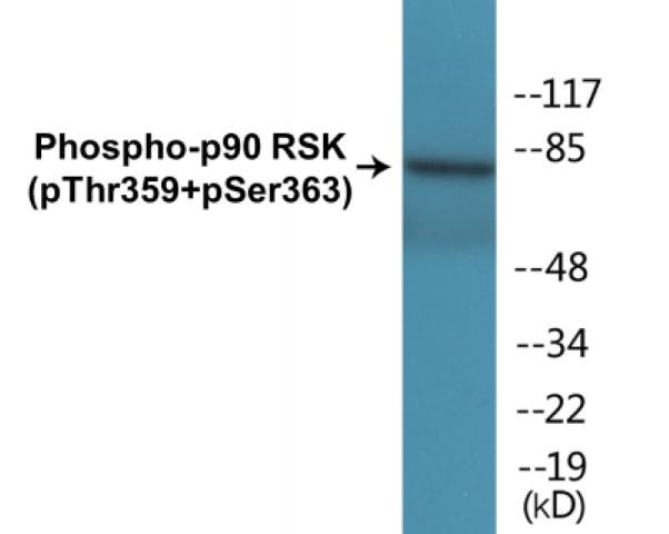 p90 RSK (Phospho-Thr359+Ser363)Colorimetric Cell-Based ELISA Kit (CBCAB00056)
