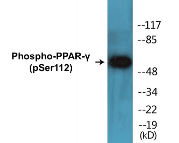 PPAR-gamma (Phospho-Ser112)Colorimetric Cell-Based ELISA Kit (CBCAB00099)