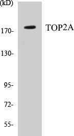 TOP2A Colorimetric Cell-Based ELISA Kit (CBCAB00132)