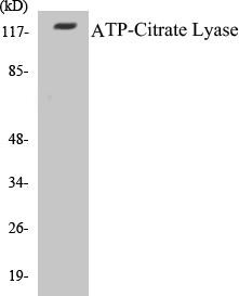 ATP-Citrate Lyase Colorimetric Cell-Based ELISA Kit (CBCAB00156)