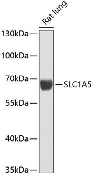 Anti-SLC1A5 Antibody (CAB12676)