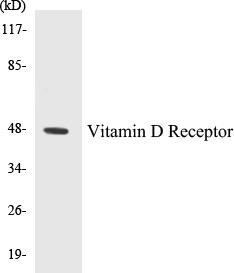 Vitamin D Receptor Colorimetric Cell-Based ELISA Kit (CBCAB00207)
