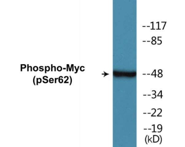 Myc (Phospho-Ser62)Colorimetric Cell-Based ELISA Kit (CBCAB00218)
