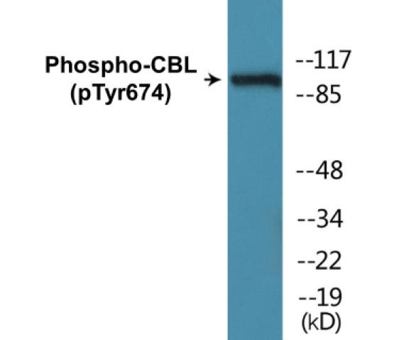 CBL (Phospho-Tyr674)Colorimetric Cell-Based ELISA Kit (CBCAB00233)