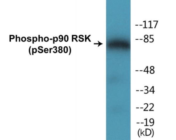p90 RSK (Phospho-Ser380)Colorimetric Cell-Based ELISA Kit (CBCAB00236)