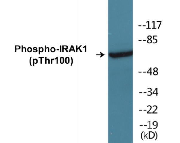 IRAK1 (Phospho-Thr100)Colorimetric Cell-Based ELISA Kit (CBCAB00247)